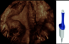 Obraz ultrasonograficzny zarejestrowany przy użyciu sondy RIC5-9-RS