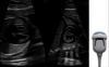 Az eM6C mátrixvizsgálófejjel rögzített ultrahangkép