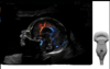 Imagine ecografică a unui fetus obținută cu sonda C2-9