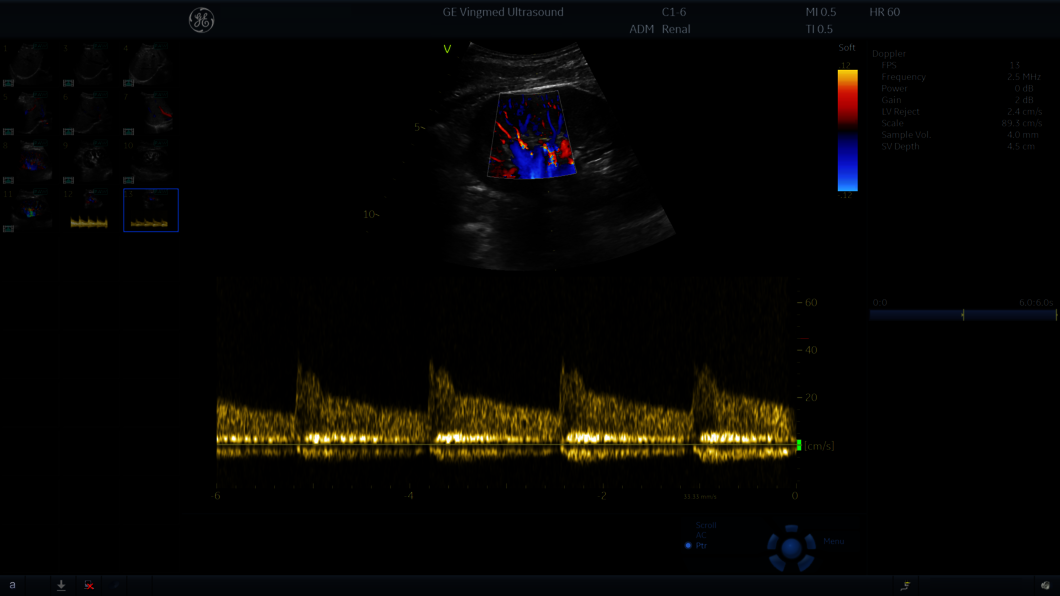 Hasi ultrahangvizsgálat során rögzített klinikai kép