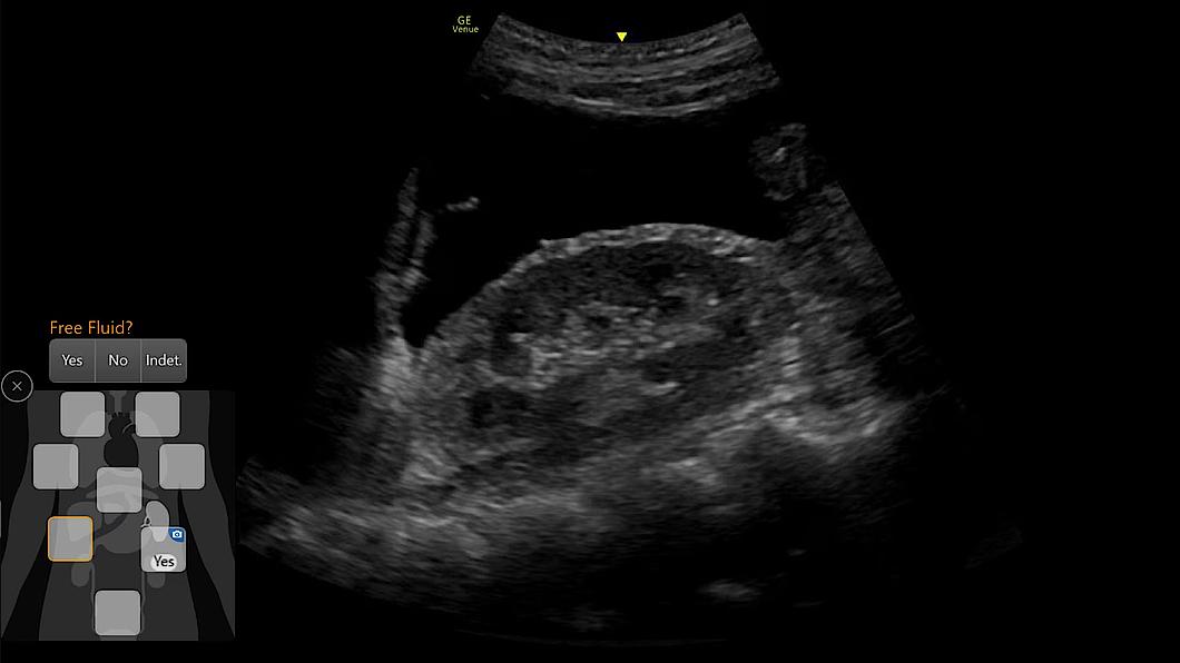 Obraz ultrasonograficzny uzyskany za pomocą narzędzia eFAST