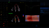 Klinický snímek zachycený pomocí funkce AFI RV