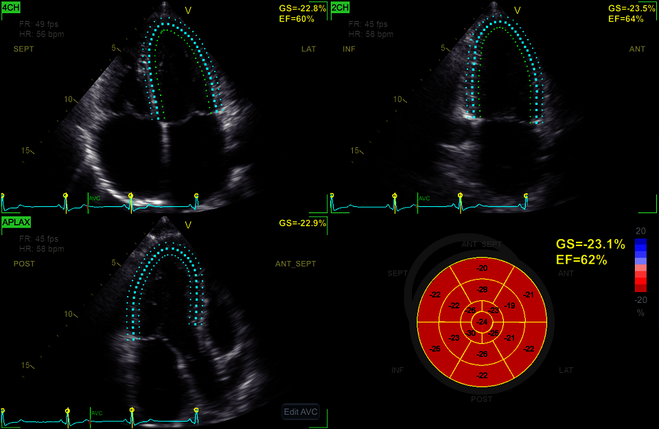 Klinický snímek zachycený nástrojem EASY AFI s rozpoznáním náhledu