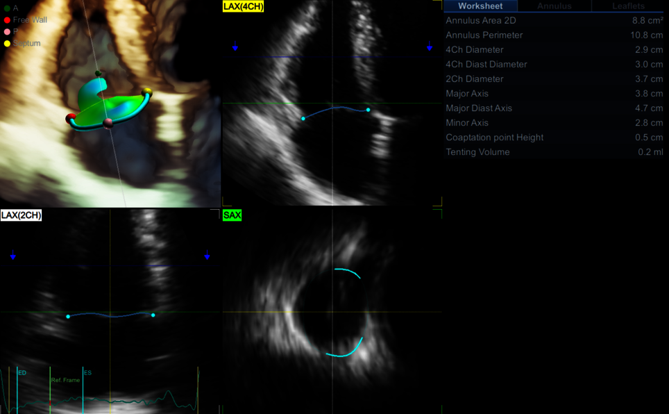 Klinický snímek zachycený pomocí aplikace 4D AUTO TVQ