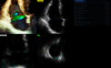 A 4D Auto TVQ használatával rögzített klinikai kép