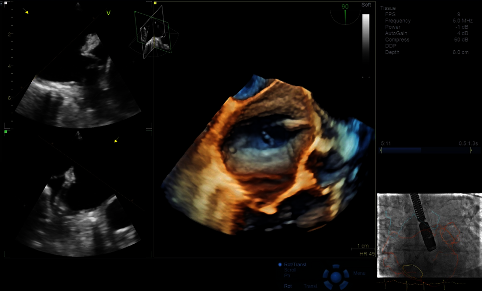 Obraz ultrasonograficzny uzyskany podczas używania View-X