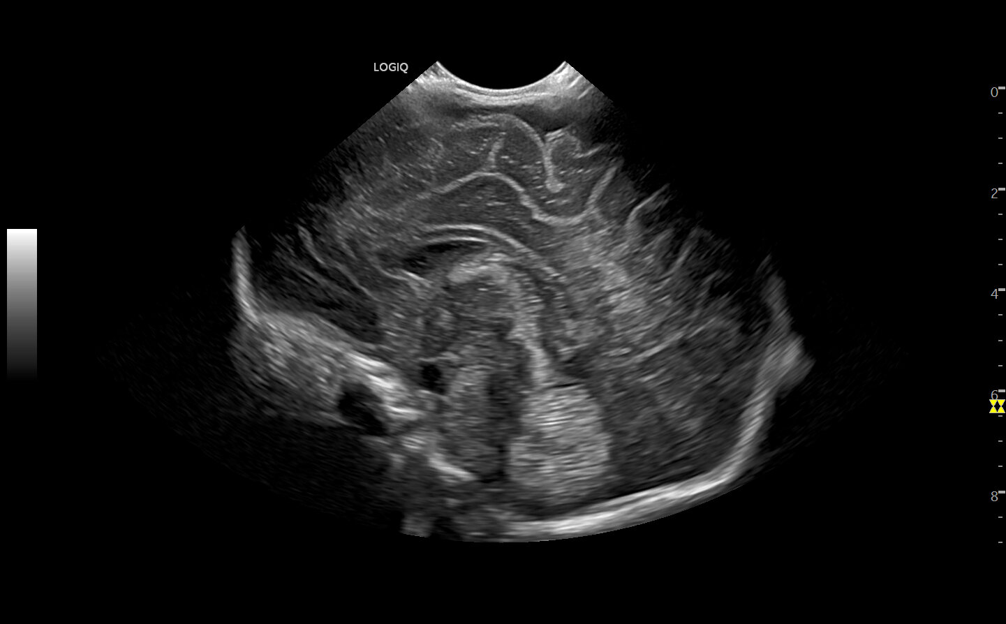Głowa noworodka, tryb B, C3-10-D